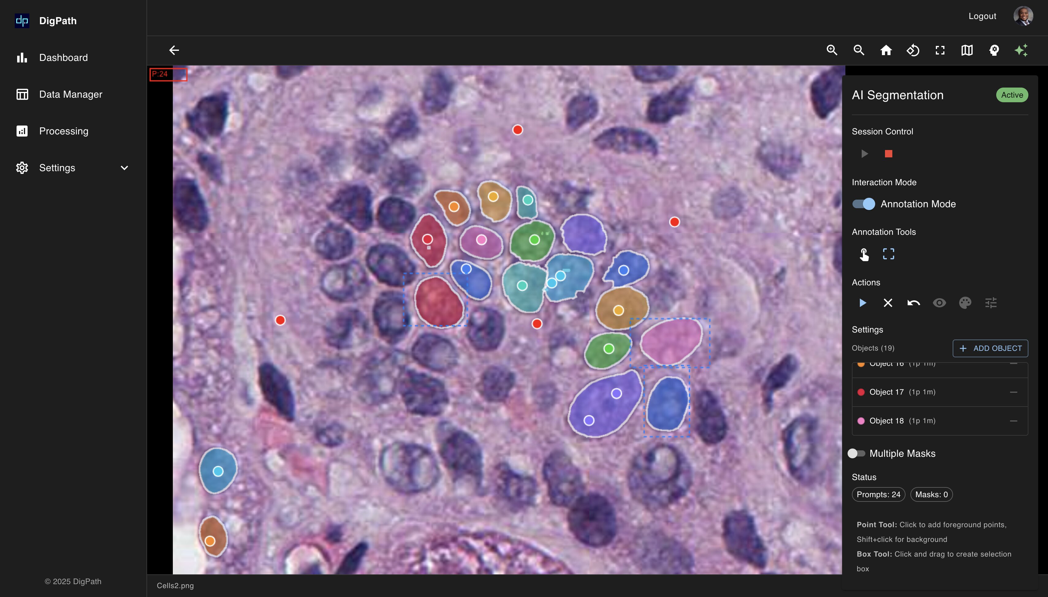 AI Cell Segmentation - Cellular level analysis and classification